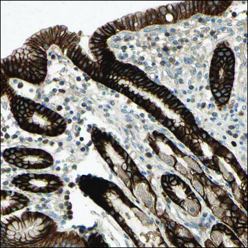 Anti-SLC7A2 antibody produced in rabbit Prestige Antibodies&#174; Powered by Atlas Antibodies, affinity isolated antibody, buffered aqueous glycerol solution