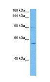 Anti-NFATC4 (AB1) antibody produced in rabbit affinity isolated antibody