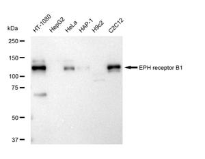 KD-Validated Anti Eph receptor B1 Antibody, clone 23GB5335, Rabbit Monoclonal clone 23GB5335, recombinant rabbit monoclonal, expressed in HEK293 cells