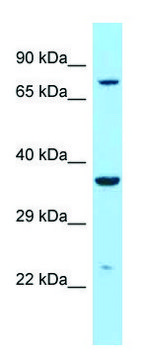 Anti-IDUA (C-terminal) antibody produced in rabbit affinity isolated antibody