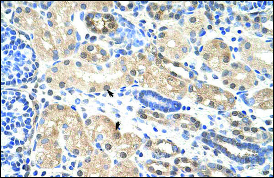 Anti-PRMT5 antibody produced in rabbit IgG fraction of antiserum