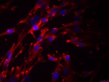 OSUMMER.5 Mouse NRAS-Mutant Melanoma Cell Line