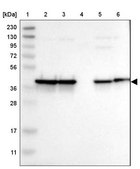 Anti-NANS antibody produced in rabbit Prestige Antibodies® Powered by Atlas Antibodies, affinity isolated antibody, buffered aqueous glycerol solution