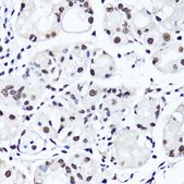 Anti-Symmetric DiMethyl-Histone H4-R3 antibody produced in rabbit