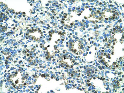 Anti-GPNMB antibody produced in rabbit affinity isolated antibody