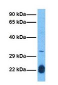 Anti-HOXB5 antibody produced in rabbit affinity isolated antibody