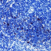 Anti-S100B antibody produced in rabbit