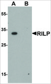 Anti-RILP antibody produced in rabbit affinity isolated antibody