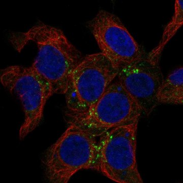 Anti-Snx2 Antibody Produced In Rabbit Prestige Antibodies&#174; Powered by Atlas Antibodies, affinity isolated antibody, buffered aqueous glycerol solution