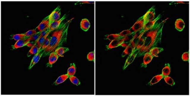 Anti-Calnexin Antibody from rabbit, purified by affinity chromatography