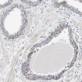 Anti-GBA antibody produced in rabbit Prestige Antibodies® Powered by Atlas Antibodies, affinity isolated antibody, buffered aqueous glycerol solution