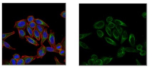 Anti-Folliculin (FLCN), Antibody clone 8D9.2 clone 8D9.2, from mouse