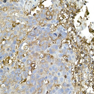 Anti-CAP1 Antibody, clone 9K4I6, Rabbit Monoclonal