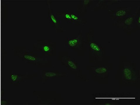 Anti-TCEB3 antibody produced in rabbit purified immunoglobulin, buffered aqueous solution