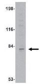 Anti-GPAT-1 Antibody from rabbit, purified by affinity chromatography