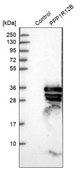 Anti-PPP1R12B antibody produced in rabbit Prestige Antibodies® Powered by Atlas Antibodies, affinity isolated antibody, buffered aqueous glycerol solution, Ab1