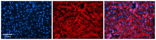 Anti-CD81 (C-terminal) antibody produced in rabbit affinity isolated antibody