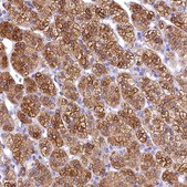 Anti-TIMM22 antibody produced in rabbit Prestige Antibodies® Powered by Atlas Antibodies, affinity isolated antibody, buffered aqueous glycerol solution