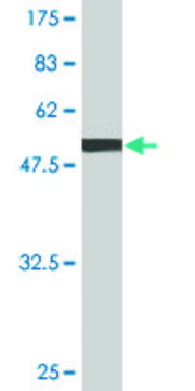 Monoclonal Anti-GSTT1 antibody produced in mouse clone 2D12-1C9, purified immunoglobulin, buffered aqueous solution