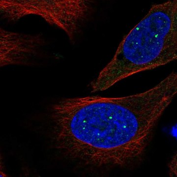 Anti-EVI5L antibody produced in rabbit Prestige Antibodies&#174; Powered by Atlas Antibodies, affinity isolated antibody