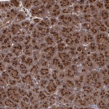 Anti-TRIP11 antibody produced in rabbit Prestige Antibodies&#174; Powered by Atlas Antibodies, affinity isolated antibody, buffered aqueous glycerol solution