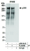 Rabbit anti-p300 Antibody, Affinity Purified Powered by Bethyl Laboratories, Inc.