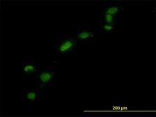 单克隆抗-HMGB1 小鼠抗 clone 1D5, purified immunoglobulin, buffered aqueous solution