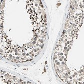 Anti-PANK2 antibody produced in rabbit Prestige Antibodies® Powered by Atlas Antibodies, affinity isolated antibody, buffered aqueous glycerol solution