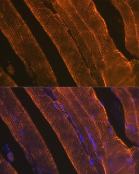 Anti-&#945;-Actin-1 (ATCA1) antibody produced in rabbit