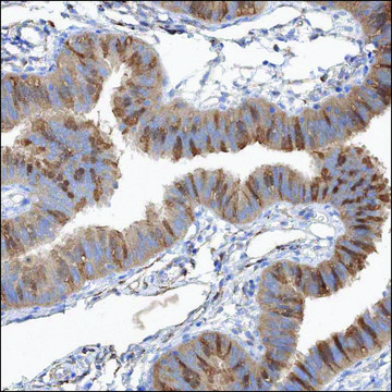 Anti-DIS3L2 antibody produced in rabbit Prestige Antibodies&#174; Powered by Atlas Antibodies, affinity isolated antibody, buffered aqueous glycerol solution