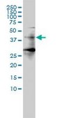 Monoclonal Anti-HDAC11 antibody produced in mouse clone 1C2-2G5, purified immunoglobulin, buffered aqueous solution