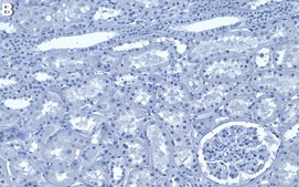 Anti-Mucin-14/EMCN Antibody, clone 1E8 ZooMAb® Rabbit Monoclonal recombinant, expressed in HEK 293 cells