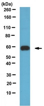 Anti-IGPR-1 Antibody 1&#160;mg/mL, from rabbit