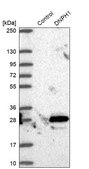 Anti-DNPH1 antibody produced in rabbit Prestige Antibodies® Powered by Atlas Antibodies, affinity isolated antibody, buffered aqueous glycerol solution, ab2