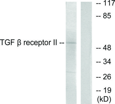 Anti-TGF &#946; Receptor II antibody produced in rabbit affinity isolated antibody