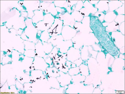 Fungi TISSUE-TROL&#8482; Control Slides from mouse lung containing Candida albicans