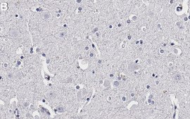Anti-NSE/Enolase-2 Antibody, clone 2J18-H1 ZooMAb® Rabbit Monoclonal recombinant, expressed in HEK 293 cells
