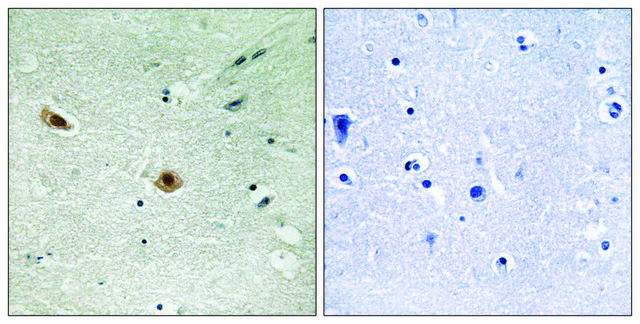 Anti-phospho-Retinoblastoma (pSer608) antibody produced in rabbit affinity isolated antibody