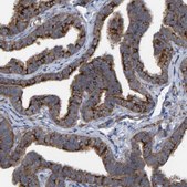 Anti-LRSAM1 antibody produced in rabbit Prestige Antibodies® Powered by Atlas Antibodies, affinity isolated antibody, buffered aqueous glycerol solution, Ab2