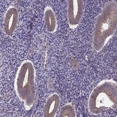 Anti-IST1 antibody produced in rabbit Prestige Antibodies® Powered by Atlas Antibodies, affinity isolated antibody, buffered aqueous glycerol solution
