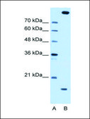 Anti-CTAGE5 antibody produced in rabbit affinity isolated antibody