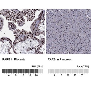 Anti-RARB antibody produced in rabbit Prestige Antibodies&#174; Powered by Atlas Antibodies, affinity isolated antibody, buffered aqueous glycerol solution