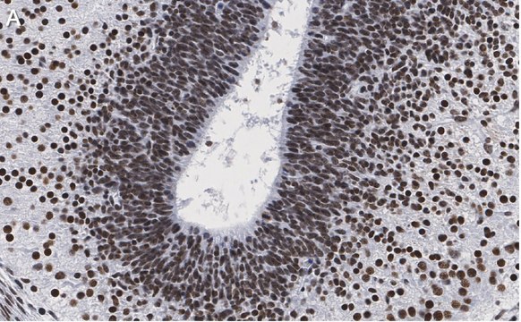 抗-LMX-1抗体，克隆4L12，ZooMAb&#174;兔单克隆抗体 recombinant, expressed in HEK 293 cells