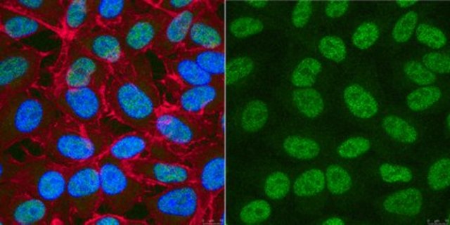 Anti-XPD Antibody, clone 22TF2-2F6 clone 22TF2-2F6, from mouse