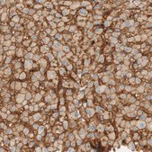 Anti-STOM antibody produced in rabbit Ab1, Prestige Antibodies® Powered by Atlas Antibodies, affinity isolated antibody, buffered aqueous glycerol solution