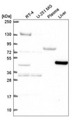 Anti-LDHD antibody produced in rabbit Prestige Antibodies® Powered by Atlas Antibodies, affinity isolated antibody