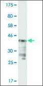 Monoclonal Anti-USP5 antibody produced in mouse clone 4G4, purified immunoglobulin, buffered aqueous solution