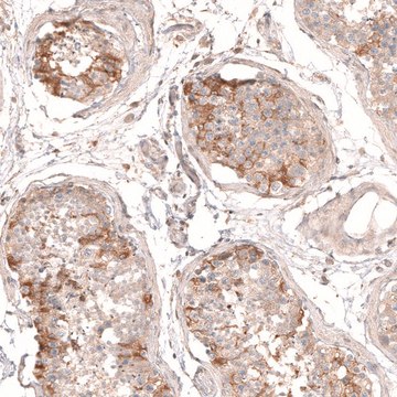 Anti-MTM1 antibody produced in rabbit Ab1, Prestige Antibodies&#174; Powered by Atlas Antibodies, affinity isolated antibody, buffered aqueous glycerol solution