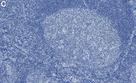 Anti-LAT Antibody, clone 2B4 ZooMAb® Rabbit Monoclonal recombinant, expressed in HEK 293 cells