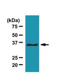 Anti-Sorting Nexin-11 Antibody from rabbit, purified by affinity chromatography